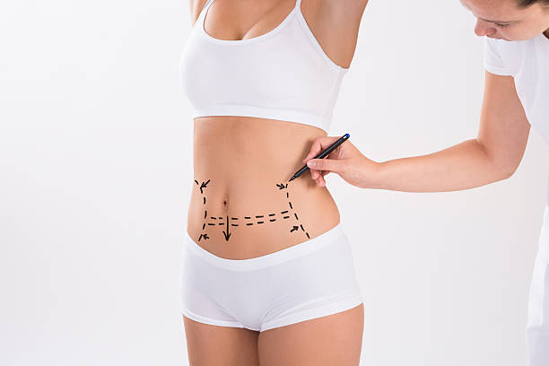 What's the Difference Between Liposuction and Tummy Tuck?